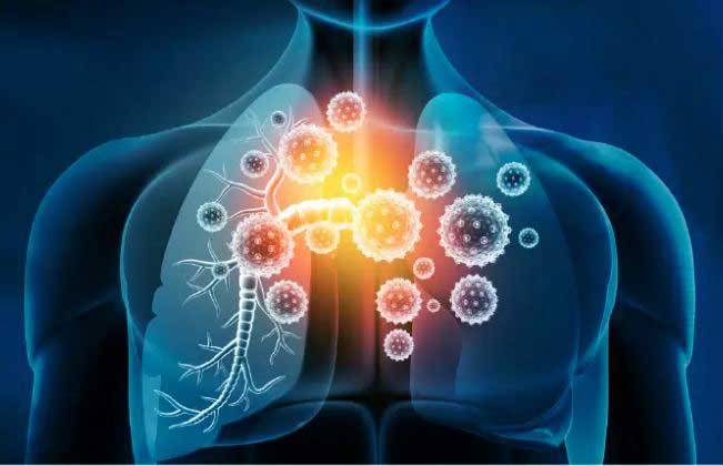 নানা প্রকার ভাইরাসজনিত রোগ ও চিকিৎসা