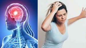 স্ট্রোক করেছেন বুঝবেন যেভাবে